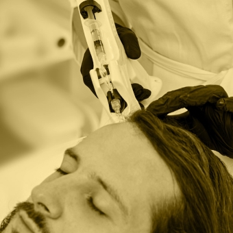 Medicina rigenerativa per capelli: cosa sono e come funzionano gli esosomi
