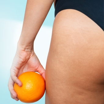 Mesoterapia corpo