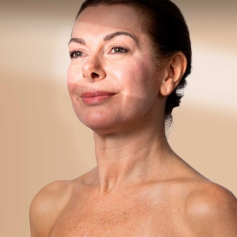 Mesoterapia viso e collo