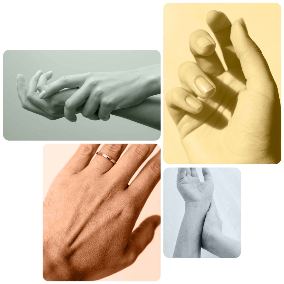 Biorivitalizzazione mani