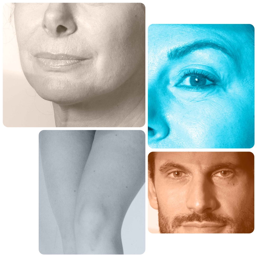 Microneedling viso e collo